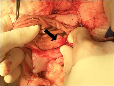 Case report: The first description of a Dieulafoy's lesion in the gastric mucosa of a dog